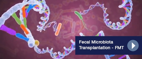 Fecal Microbiota Transplantation — FMT